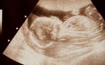 邯郸妇幼试管婴儿技术，2026年生殖科助孕成功率全解析